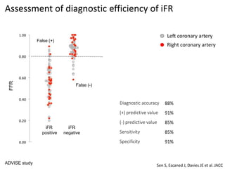 iFR
positive
iFR
negative
FFR
False (+)
False (-)
Assessment of diagnostic efficiency of iFR
Left coronary artery
Right coronary artery
Sen S, Escaned J, Davies JE et al. JACC
ADVISE study
Diagnostic accuracy
(+) predictive value
(-) predictive value
Sensitivity
Specificity
88%
91%
85%
85%
91%
 