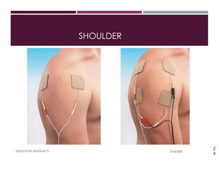 Interferential Therapy / Interferential Current (IFC) I Physiotherapy ...