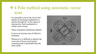 4 Pole method using automatic vector
scan
• It is possible to move the clover leaf
pattern of maximum modulation to
and fro through 45° in the region of
intersection. Such mechanism is
called vector sweep.
• There is dynamic interference pattern.
• It serves to increase area of effective
treatment.
• Whenever it is difficult to identify the
exact site of tissue involvement
scanning mode is preferable than the
static mode.
25
 