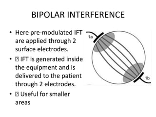 BIPOLAR INTERFERENCE
• Here pre-modulated IFT
are applied through 2
surface electrodes.
• 􏰀 IFT is generated inside
the equipment and is
delivered to the patient
through 2 electrodes.
• 􏰀 Useful for smaller
areas
 