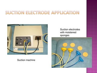 Suction electrodes
                  with moistened
                  sponges




Suction machine
 