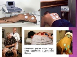 Electrodes placed above Thigh ,
Knee , Upper back & Lower back
Region
 