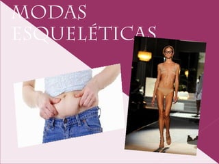 MODAS
ESQUELÉTICAS.
 