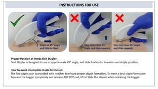 INSTRUCTIONS FOR USE
45°
Staple at 45° angle
and Slide to Next
Very more than 45°
angle and Slide upward
Very Less than 45° angle
and Slide upward
Proper Position of Imeds Skin Stapler:
Skin Stapler is designed to use at approximate 45° angle, and slide horizontal towards next staple position,
How to avoid incomplete staple formation:
The flat staple span is provided with notches to ensure proper staple formation, To meet a best staple formation
Squeeze the trigger completely and release, DO NOT pull, lift or Slide the stapler when releasing the trigger.
 