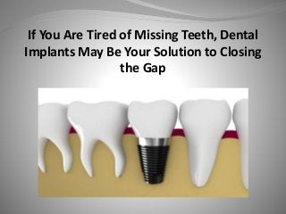 If You Are Tired of Missing Teeth, Dental
Implants May Be Your Solution to Closing
the Gap
 