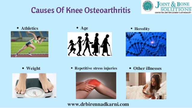 Best Natural Treatment For Osteoarthritis Of The Knee Best Natural Treatment For Osteoarthritis Of The Knee