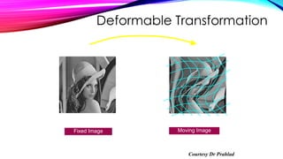 Deformable Transformation
Fixed Image
Moving ImageFixed Image
Courtesy Dr Prahlad
 