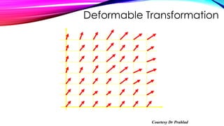 Deformable Transformation
Courtesy Dr Prahlad
 