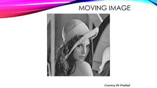 MOVING IMAGE
Courtesy Dr Prahlad
 