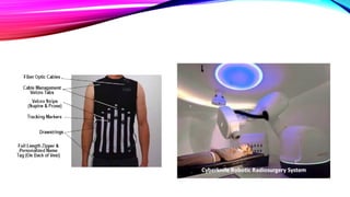 Cd R Radiotherapy Image guided adaptive radiotherapy | PDF