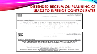 DISTENDED RECTUM ON PLANNING CT
LEADS TO INFERIOR CONTROL RATES
 