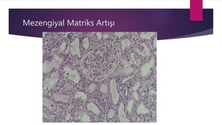 Mezengiyal Matriks Artışı
 