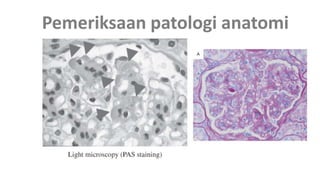 Pemeriksaan patologi anatomi
 