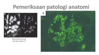 Pemeriksaan patologi anatomi
 