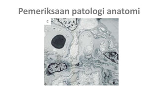 Pemeriksaan patologi anatomi
 