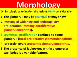 Morphology
On histologic examination the lesions vary considerably.
1.The glomeruli may be normal or may show
2. mesangial widening and endocapillary
proliferation (mesangioproliferative
glomerulonephritis),
3.segmental proliferation confined to some
glomeruli (focal proliferative glomerulonephritis),
4. or rarely, overt crescentic glomerulonephritis.
5.The presence of leukocytes within glomerular
capillaries is a variable feature.
 