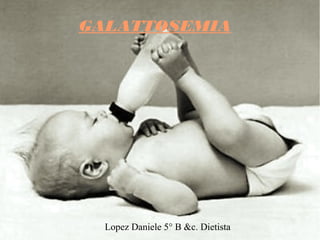 GALATTOSEMIA




  Lopez Daniele 5° B &c. Dietista
 