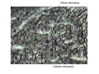 Fibras reticulares
Células reticulares
 