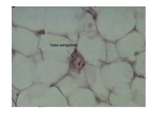Vaso sanguineo
 