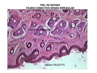 PIEL DE BOVINO
TEJIDO CONECTIVO DENSO IRREGULAR
Epitelio PEQCPTC
Folículos pilosos
Glándulas cebaseas
 