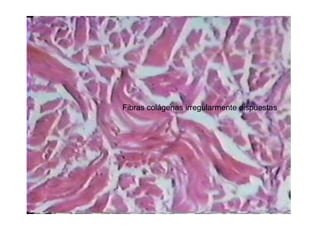 Fibras colágenas irregularmente dispuestas
 