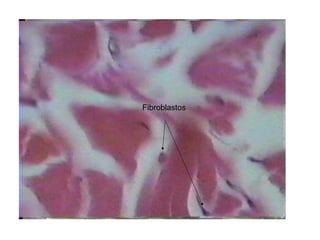 Fibroblastos
 