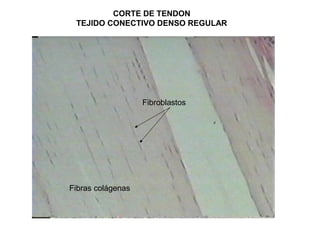 CORTE DE TENDON
TEJIDO CONECTIVO DENSO REGULAR
Fibroblastos
Fibras colágenas
 