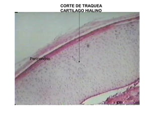 CORTE DE TRAQUEA
CARTILAGO HIALINO
Pericondrio
 