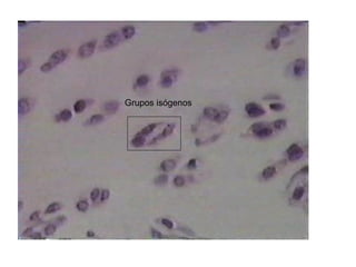 Grupos isógenos
 