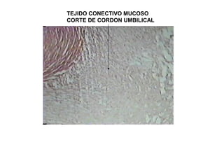 TEJIDO CONECTIVO MUCOSO
CORTE DE CORDON UMBILICAL
 