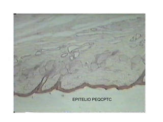 EPITELIO PEQCPTC
 