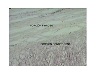 PORCIÓN CONDROGENA
PORCIÓN FIBROSA
 