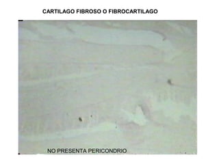 CARTILAGO FIBROSO O FIBROCARTILAGO
NO PRESENTA PERICONDRIO
 