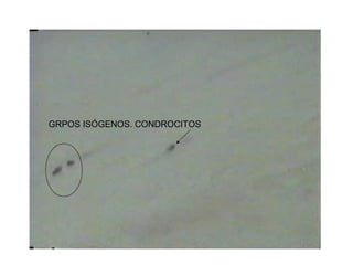 GRPOS ISÓGENOS. CONDROCITOS
 