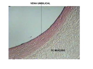 VENA UMBILICAL
TC MUCOSO
 