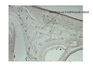 TRAVÉCULAS O ESPÍCULAS OSEAS
 