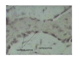 OSTEOBLASTOS
OSTEOCITOS
 