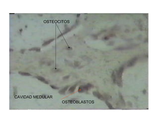 CAVIDAD MEDULAR
OSTEOBLASTOS
OSTEOCITOS
 