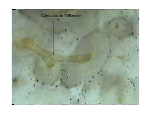 Conducto de Volkmann
 