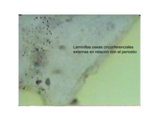 Laminillas oseas circunferenciales
externas en relación con el periostio
 