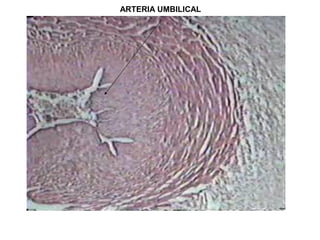 ARTERIA UMBILICAL
 