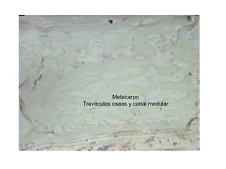 Metacarpo
Travéculas oseas y canal medular
 