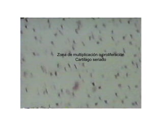 Zona de multiplicación o proliferación
Cartilago seriado
 