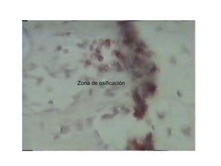 Zona de osificación
 