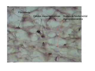 Células mesenquimáticas
Fibroblasto
Sustancia fundamental
mucopolisacáridos
 