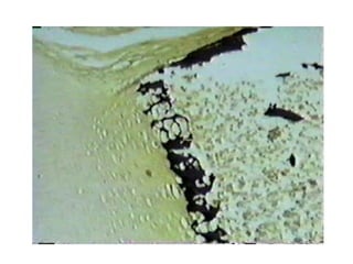 Práctica de Tejido Conectivo