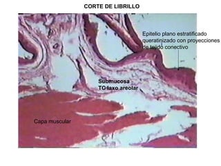 CORTE DE LIBRILLO
Epitelio plano estratificado
queratinizado con proyecciones
de tejido conectivo
Capa muscular
Submucosa
TC laxo areolar
 