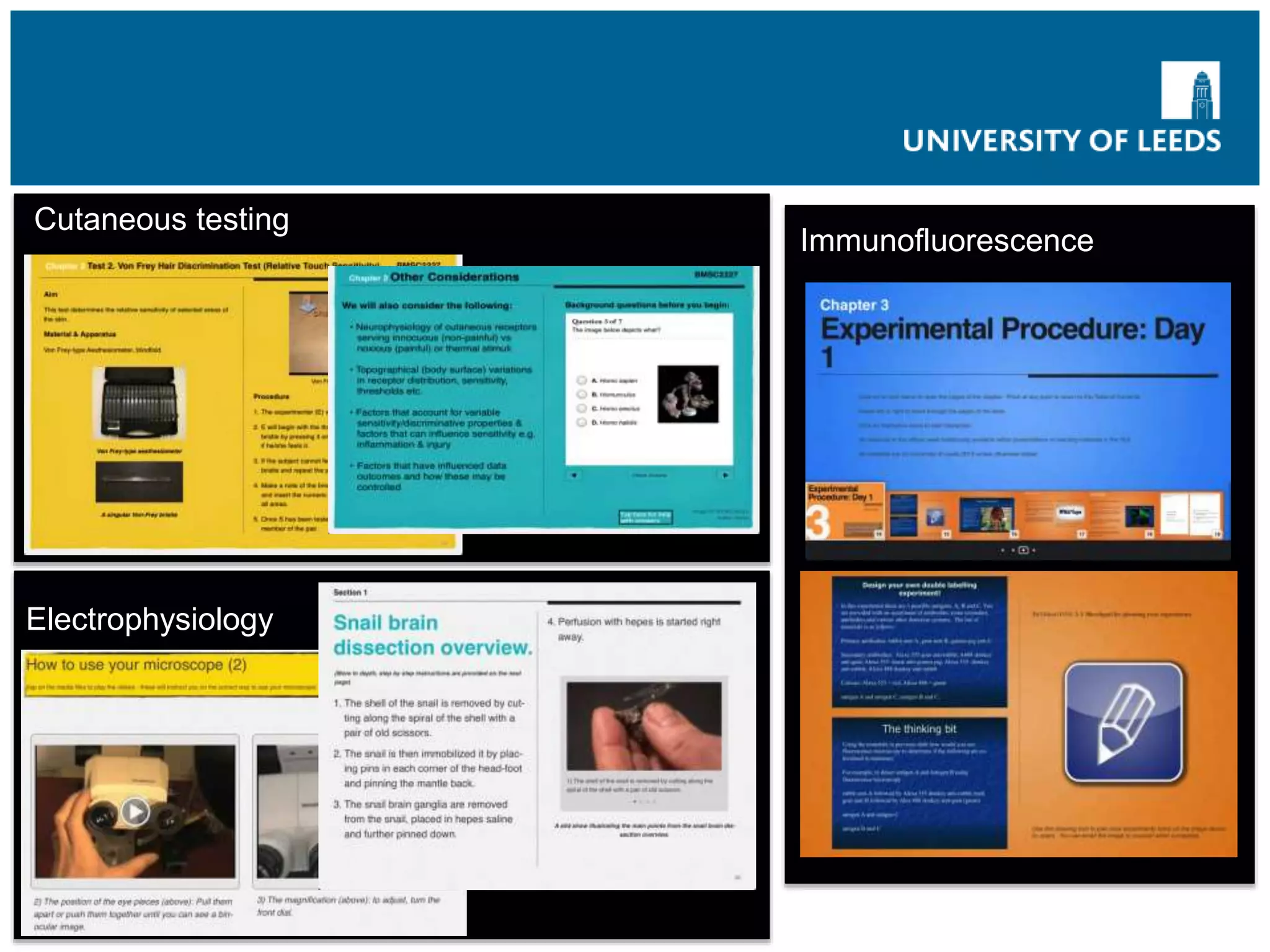 Cutaneous testing
Immunofluorescence
Electrophysiology
 