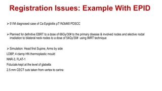 Epid Form Image Guided Radiotherapy | PPTX