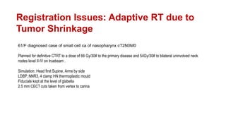 Image Guided Radiotherapy | PPTX